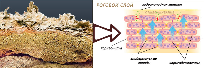 Роговой слой кожи